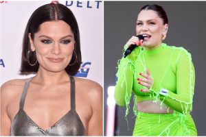 Atlikėjai Jessie J nustatyti rimti neurologiniai sutrikimai